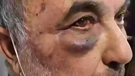 El rostro de Gerala luego del asalto, por parte de una banda, a su casa en Morillo.